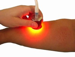 СВИТ: эффективное лечение целлюлита сочетанием света и вакуумного массажа